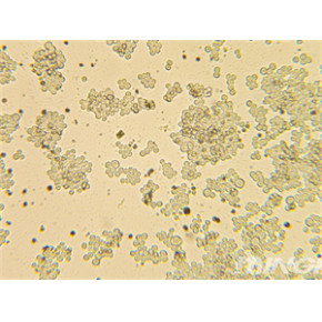 细胞培养观察实验倒置显微镜-MHIL150